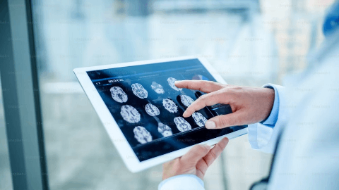 EyePoint Announces Positive Recommendation from Independent Data Safety Monitoring Committee for Pivotal Phase 3 Trials for DURAVYU™ in Wet Age-Related Macular Degeneration