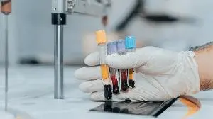 Novartis completes acquisition of Tourmaline Bio