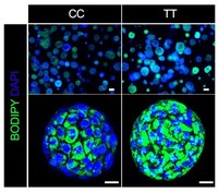 Why Type 2 Diabetes Leads to Liver Damage for Some, Not Others