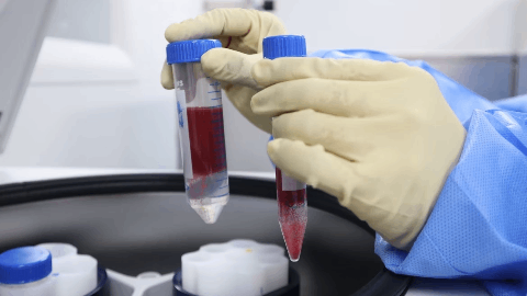 argenx Provides Update on Phase 3 UNITY Study of Efgartigimod SC in Sjögren's Disease