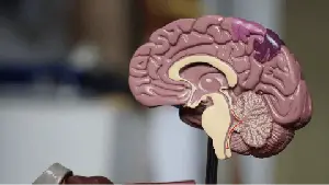 Scientists reprogram brain immune cells to fight Alzheimer’s