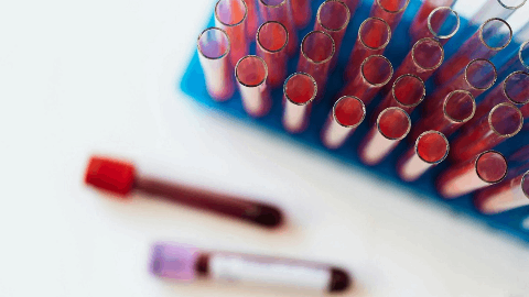 Rectify Pharma Presents Translational Data Demonstrating Improvements in Kidney Function and Reductions in Vascular Calcification at ERA 2025