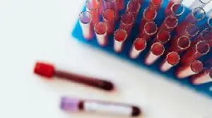 Rectify Pharma Presents Translational Data Demonstrating Improvements in Kidney Function and Reductions in Vascular Calcification at ERA 2025