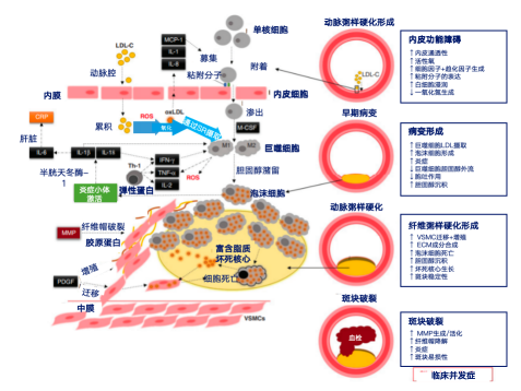 司美格鲁肽：可通过改善炎症状态降低ASCVD的发生风险！