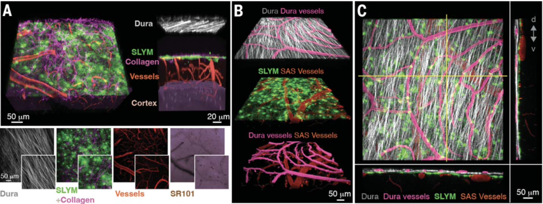 《科学》：改写教科书！科学家首次发现，人类大脑或存在第四层脑膜！