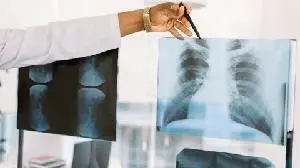 ArriVent Announces First Patient Dosed in Global Pivotal Phase 3 ALPACCA Trial Evaluating Firmonertinib for First-Line Treatment of EGFR PACC Mutant Non-Small Cell Lung Cancer