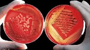 ACTG Presents Study at CROI Demonstrating Potential of CMV-specific Antiviral Inhibitor to Improve Aging-Related Outcomes among People Living with HIV and CMV (Cytomegalovirus)