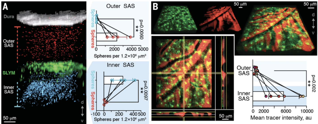 《科学》：改写教科书！科学家首次发现，人类大脑或存在第四层脑膜！