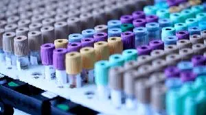 IntraGel Therapeutics and UroGen Pharma Sign Strategic Collaboration and Investment Agreements to Advance Sustained-Released Investigational Oncology Therapies