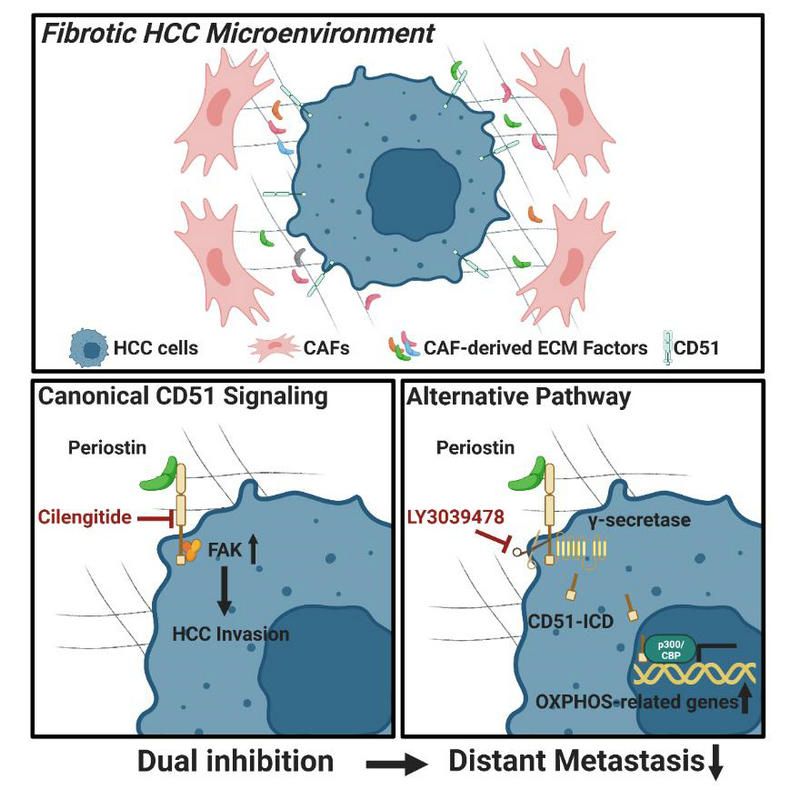 研究发现促进肝细胞癌远处转移的新机制