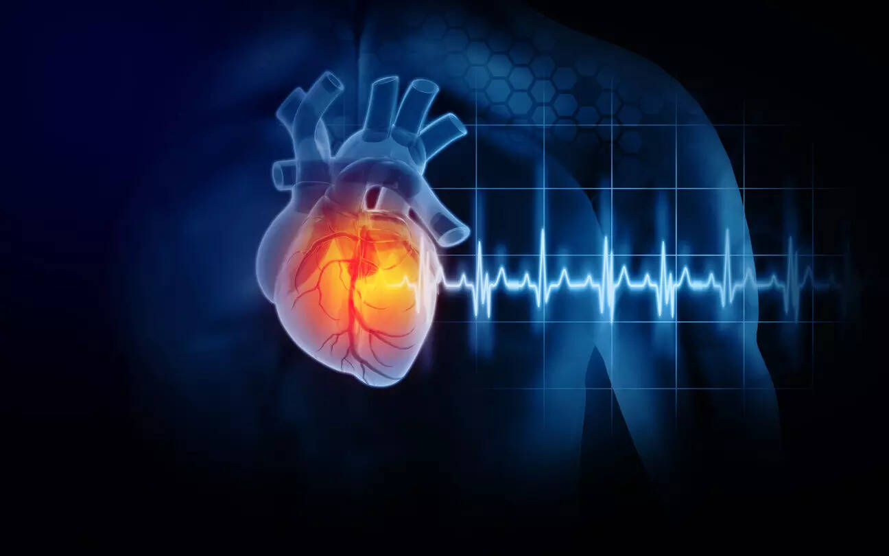 Cytokinetics' heart disease drug shows improvement over standard of care in study