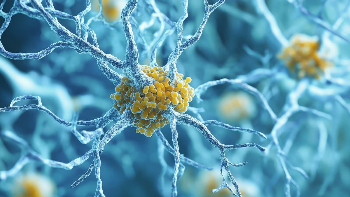 p-tau217 Linked to Incident MCI, Dementia 25 Years Later in Older Women