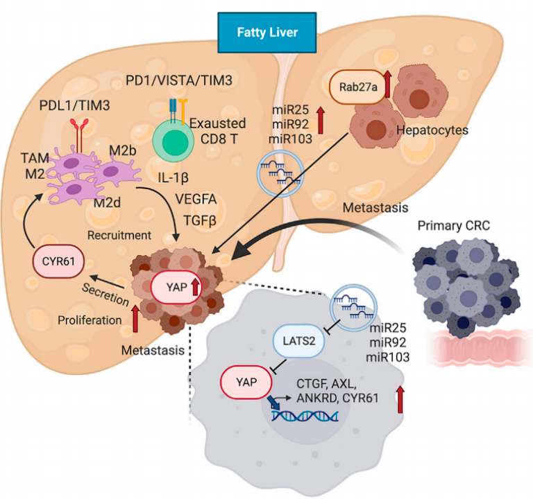 《细胞·代谢》：脂肪肝促进肠癌肝转移的机制，找到了！