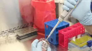 Keros Therapeutics Announces the First Patient Dosing in the Phase 3 RENEW Clinical Trial of Elritercept