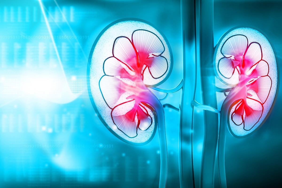 Previous COVID-19 Tied to Increased Risk for Kidney Disease