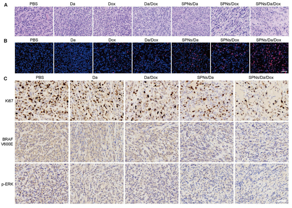 Theranostics：达普拉非尼与阿霉素共负载超分子纳米协同治疗甲状腺癌