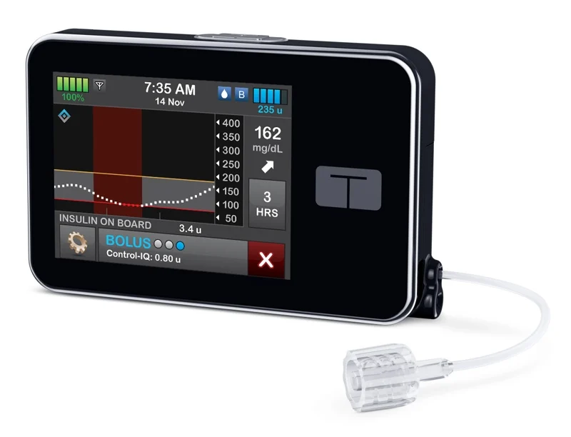 Tandem's glucose-predicting tech improves time in range by 15% for people with Type 2 diabetes: study