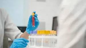 Immedica announces positive results from phase 3 study of Loargys® (pegzilarginase) in patients below 2 years