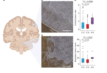 Nature：重磅！科学家识别出了能指示人类多发性硬化症严重程度的首个遗传标志物