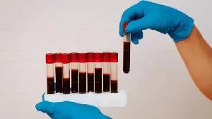 Zemcelpro® (dorocubicel) Positive Results in High- and Very High-Risk Blood Cancers to be Reported at the EBMT 2026 Annual Meeting