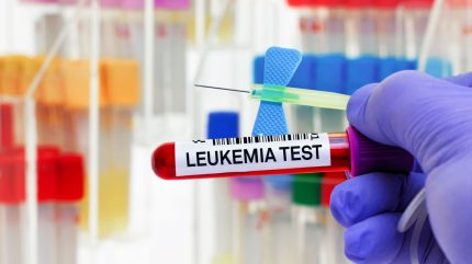 FDA approves Syndax’s Revuforj to treat leukaemia