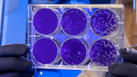 Acurx Announces New Ibezapolstat Clinical Trial Program in Patients with Recurrent CDI That Has the Potential to Shift the Paradigm of Treatment and Prevention of C. difficile Infection