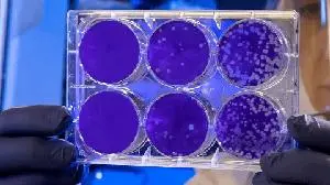 Acurx Announces New Ibezapolstat Clinical Trial Program in Patients with Recurrent CDI That Has the Potential to Shift the Paradigm of Treatment and Prevention of C. difficile Infection