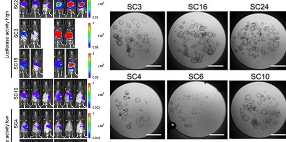 Kanazawa University research: Cancer biology: Some cancer cells can lose their capability to migrate