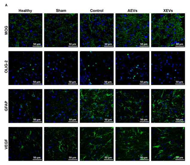 Molecular Therapy Nucleic Acids: 细胞外小泡有效改善脑出血