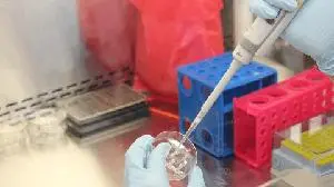 Amneal Highlights Positive Topline Results from Confirmatory Clinical Study of Biosimilar Candidate to XOLAIR(R) (omalizumab), Developed by Kashiv BioSciences