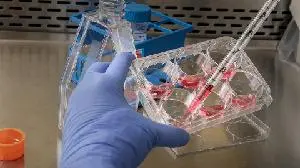 Revium Rx (RVRC) Completes Acquisition of LipoVation Ltd.