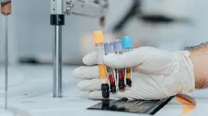 FDA clears Pfizer's Talzenna-Xtandi combo for earlier-line prostate cancer