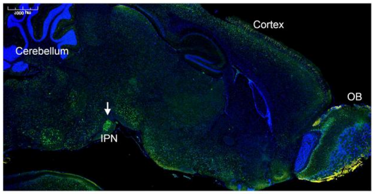 鼻内给药CRISPR基因编辑系统，绕过血脑屏障，治疗焦虑症
