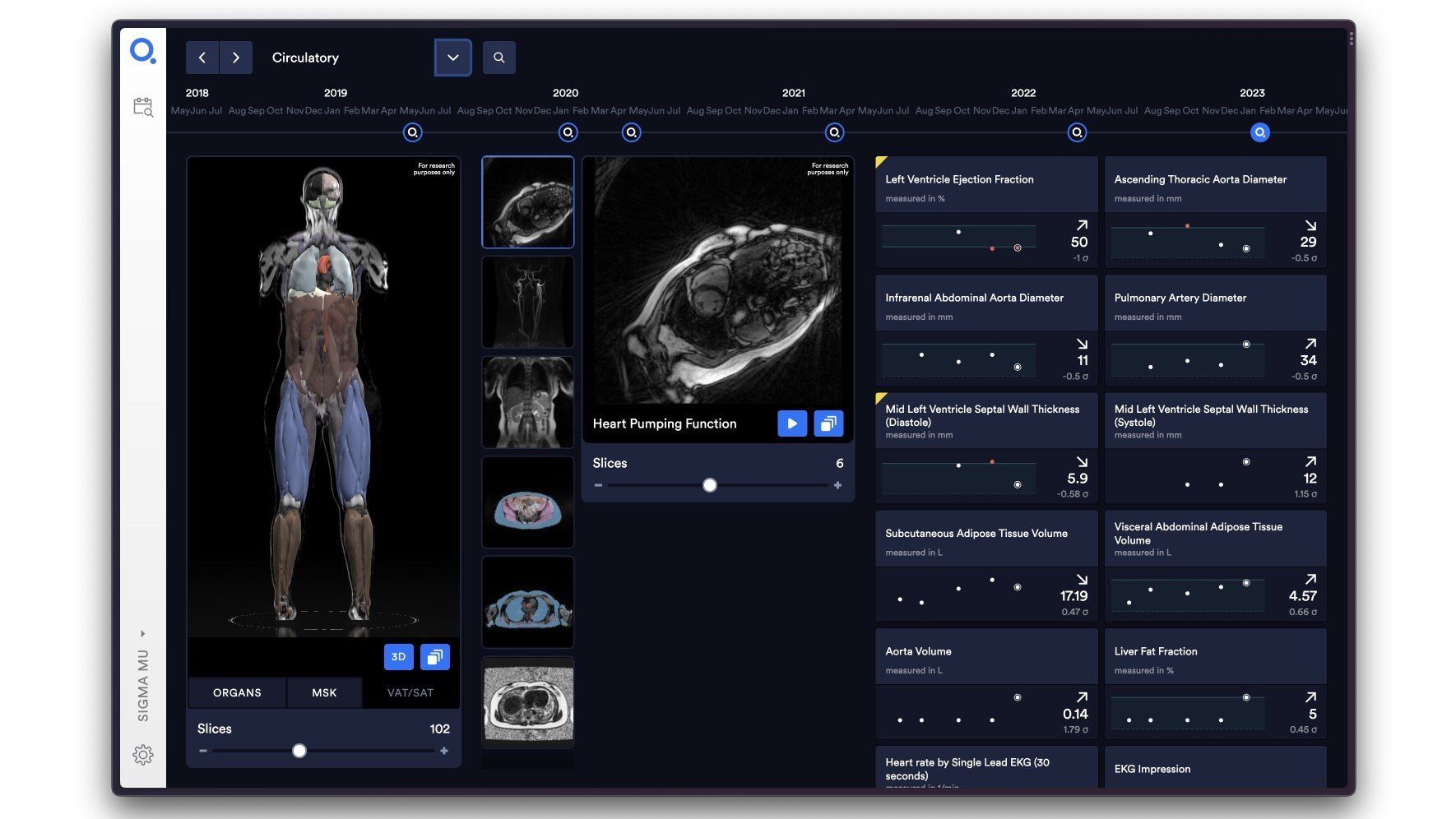 Old MRI, new tricks: Q Bio puts forward quantifiable, reproducible scanning approach