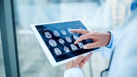 Shape Therapeutics Shares Breakthrough Preclinical Data for Non-Invasive Treatment of Parkinson’s Disease Using a Brain Targeted AAV Gene Therapy at the European Society of Gene & Cell Therapy 32nd Annual Congress