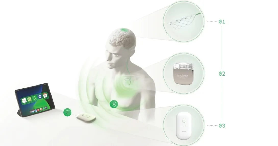 Brain-computer interface company Synchron raises $200M