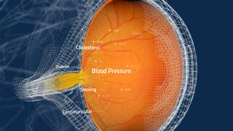 Toku Obtains CE and UKCA Marks for AI Cardiovascular Risk Assessments Through the Eye