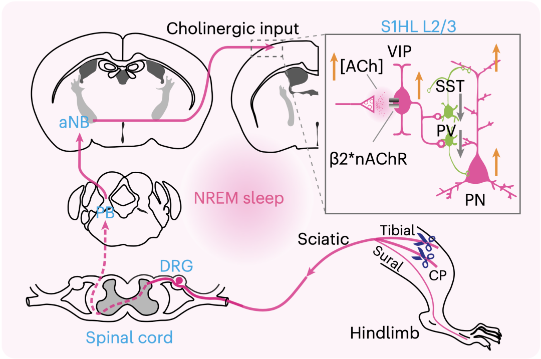 《自然·神经科学》：越睡身上越疼？华人科学家首次揭示睡眠促进慢性疼痛形成与维持的机制