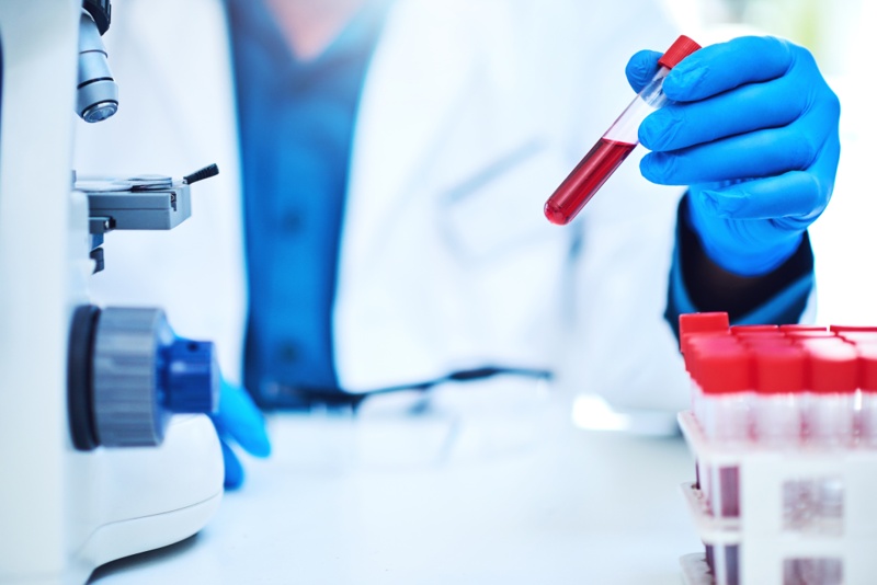 Eisai to drop up to $15M on C2N Diagnostics to boost the reach of Alzheimer's disease blood tests