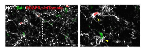 PNAS：科学家识别出人类神经退行性疾病发生期间小胶质细胞增生的新型细胞来源