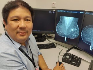 AI Tool 'Picks up Early-stage Breast Cancers Doctors Missed'