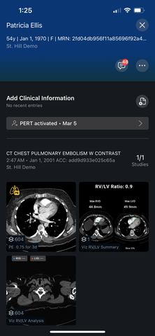 New Viz.ai Study Demonstrates Reduced Mortality Rates in Patients with Pulmonary Embolism
