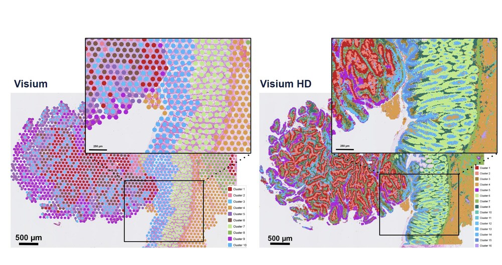 10x Genomics Commercially Launches Visium HD Spatial Gene Expression Assay