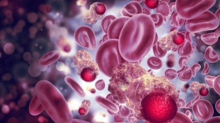 Immune-Onc’s antibody therapy collects second FDA orphan designation