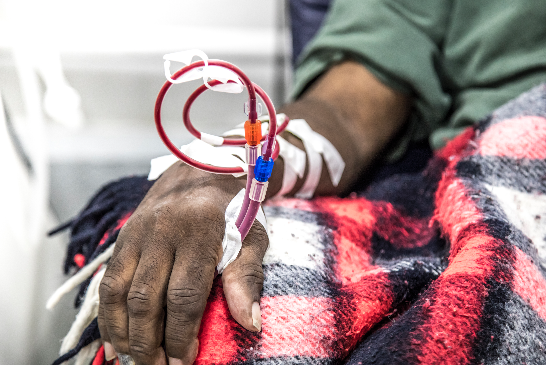 Invizius completes first-in-human dialysis trial to quell ‘angry blood’