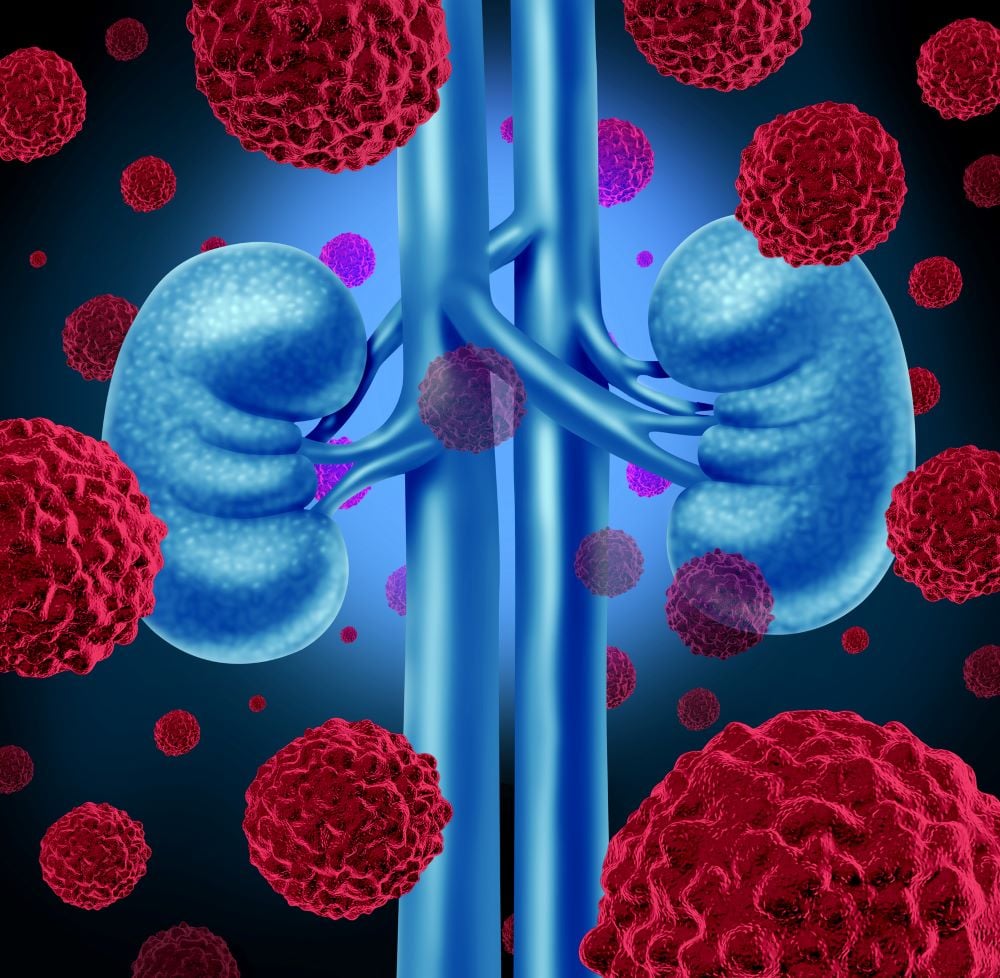 ESMO: Merck exec sees signs of 'prolonged benefit' from Welireg in kidney cancer