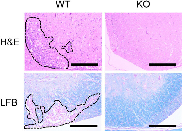 Key protein linked to immune disorders