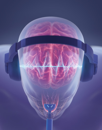 Neuromod Publishes Results of Second Large Scale Clinical Trial for Tinnitus in Top-Tier Scientific Journal, Shows Greater Improvement of Symptoms