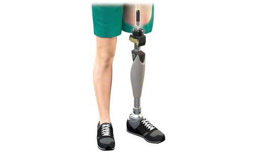 NYU Langone's Center for Amputation Reconstruction Launches Osseointegration Program with FDA-Approved Implant System