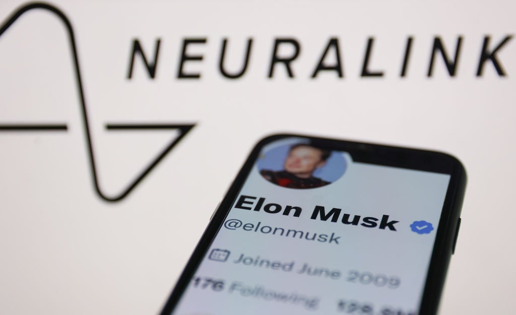 Elon Musk claims first Neuralink implant patient can already control a mouse with their thoughts